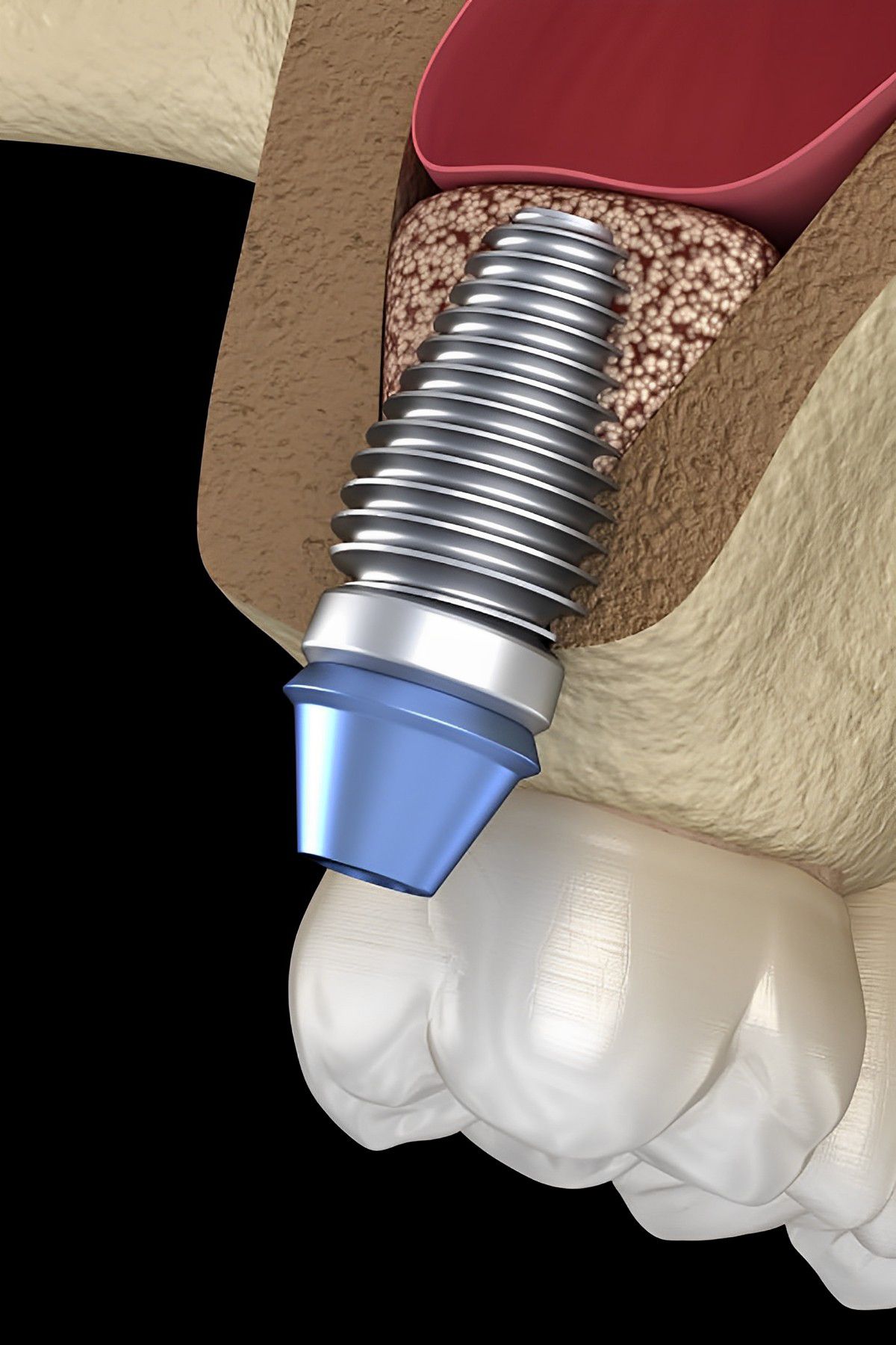 /wp-content/themes/aj-brardental/img/inner_image_43.jpg